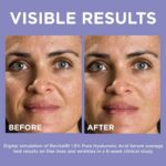 L’Oréal Paris Revitalift 1.5% Pure Hyaluronic Acid Face Serum - Image 2